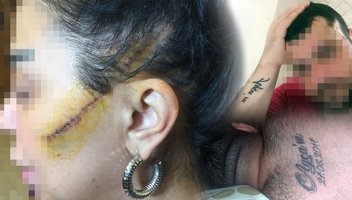 Saplantılı erkek dehşeti: Dövüp yüzünü usturayla kesti
