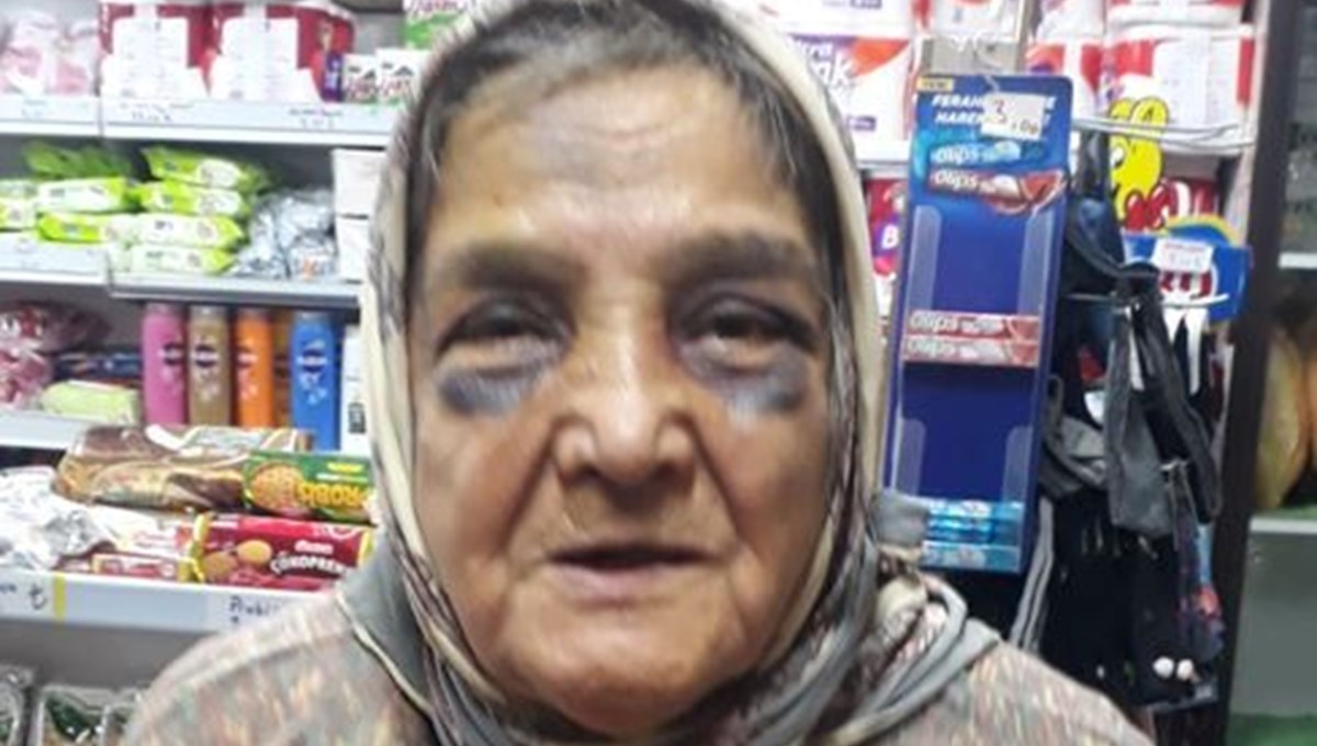 Kocaeli'de eşinin dövdüğü 73 yaşındaki kadın, konukevine yerleştirildi